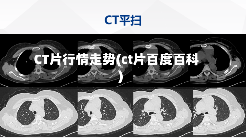 CT片行情走势(ct片百度百科)